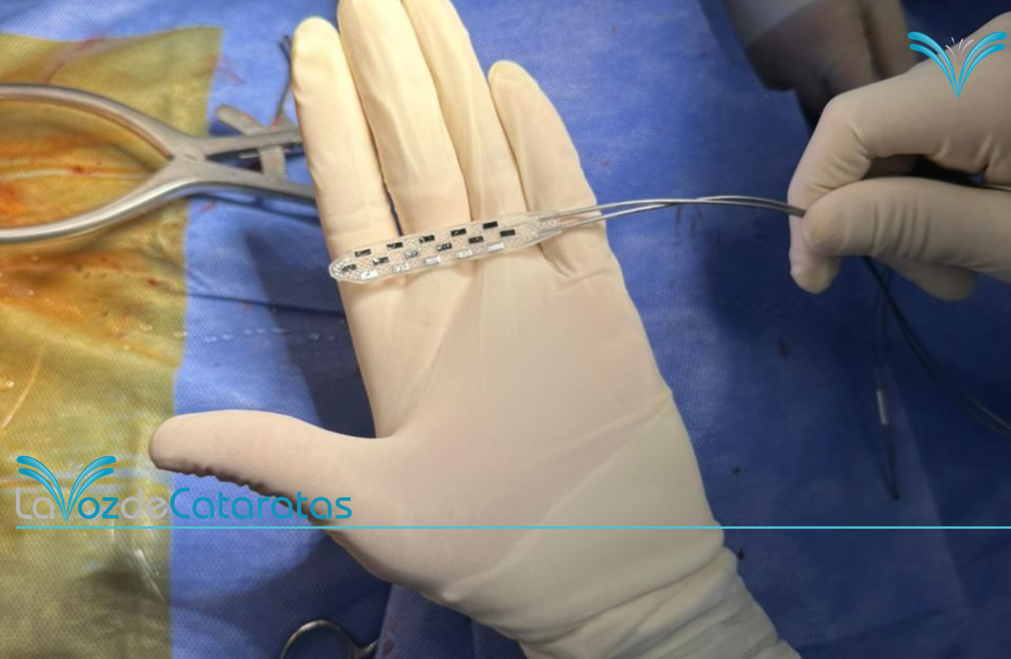 El SAMIC Iguazú realizó el primer implante de neuroestimulador para tratar el dolor imagen-10