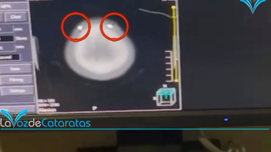 lo balearon con balines en la cabeza